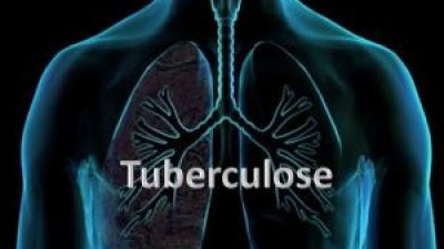 Identificado mecanismo molecular com potencial para fármacos contra tuberculose